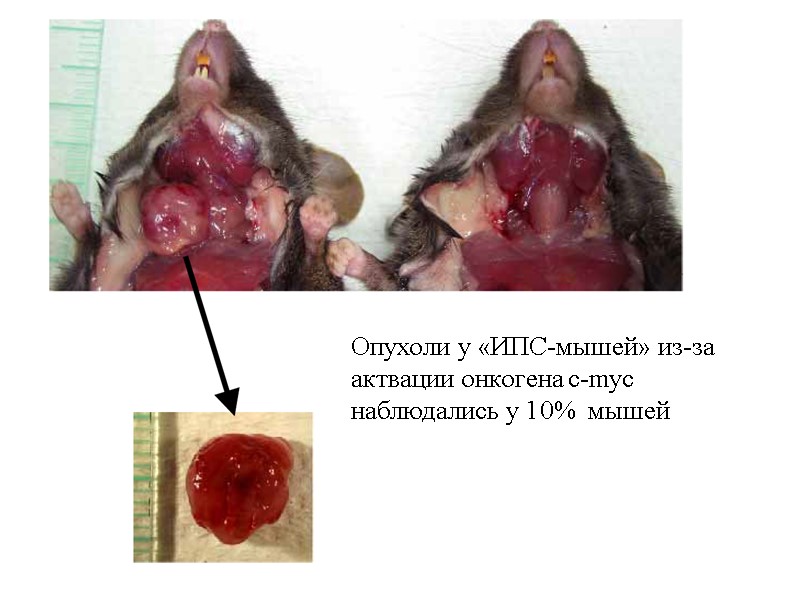 Опухоли у «ИПС-мышей» из-за актвации онкогена c-myc наблюдались у 10%  мышей